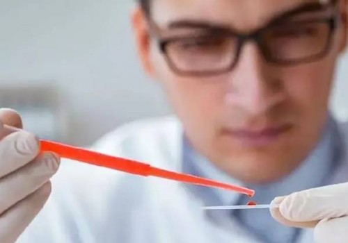 青岛助孕机构：想治好男性精子活力低的问题？这4种方法可以帮到你