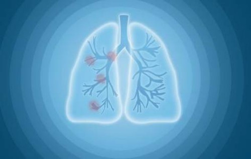 我想做试管生一个男孩，试管生男孩费用明细建议提前须知